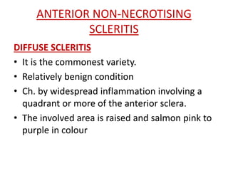 ANTERIOR NON-NECROTISING
SCLERITIS
DIFFUSE SCLERITIS
• It is the commonest variety.
• Relatively benign condition
• Ch. by widespread inflammation involving a
quadrant or more of the anterior sclera.
• The involved area is raised and salmon pink to
purple in colour
 