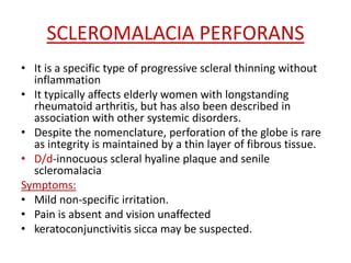SCLEROMALACIA PERFORANS
• It is a specific type of progressive scleral thinning without
inflammation
• It typically affects elderly women with longstanding
rheumatoid arthritis, but has also been described in
association with other systemic disorders.
• Despite the nomenclature, perforation of the globe is rare
as integrity is maintained by a thin layer of fibrous tissue.
• D/d-innocuous scleral hyaline plaque and senile
scleromalacia
Symptoms:
• Mild non-specific irritation.
• Pain is absent and vision unaffected
• keratoconjunctivitis sicca may be suspected.
 
