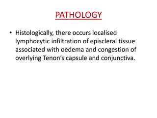 PATHOLOGY
• Histologically, there occurs localised
lymphocytic infiltration of episcleral tissue
associated with oedema and congestion of
overlying Tenon’s capsule and conjunctiva.
 
