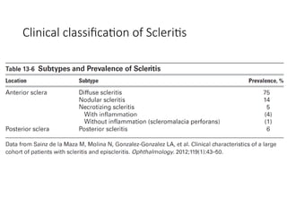 Scleritis Racgp Episcleritis and Scleritis CLASSIFICATION AND MANAGEMENT | PPTX