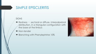 Redness Limbus EPISCLERITIS AND SCLERITIS- PRESENTATION.pptx