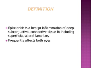  Episcleritis is a benign inflammation of deep
subconjuctival connective tissue in including
superficial scleral lamellae.
 Frequently affects both eyes
 