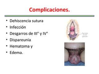 Complicaciones.
•   Dehiscencia sutura
•   Infección
•   Desgarros de III° y IV°
•   Dispareunia
•   Hematoma y
•   Edema.
 