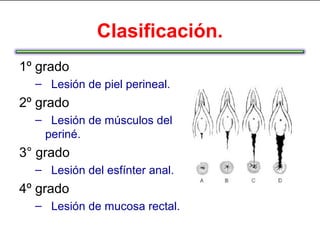 Clasificación.
1º grado
  – Lesión de piel perineal.
2º grado
  – Lesión de músculos del
   periné.
3° grado
  – Lesión del esfínter anal.
4º grado
  – Lesión de mucosa rectal.
 