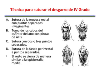 Técnica para suturar el desgarro de IV Grado

A. Sutura de la mucosa rectal
   con puntos separados
   invaginantes.
B. Toma de los cabos del
   esfínter del ano con pinzas
   de Allis.
C. Sutura con dos o tres puntos
   separados.
D. Sutura de la fascia perirrectal
   a puntos separados.
• El resto se cierra de manera
   similar a la episiorrafia
   media.
 