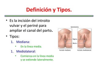 Definición y Tipos.
• Es la incisión del introito
  vulvar y el periné para
  ampliar el canal del parto.
• Tipos:
   1. Mediana:
     •   En la línea media.
   1. Mediolateral:
     •   Comienza en la línea media
         y se extiende lateralmente.
 