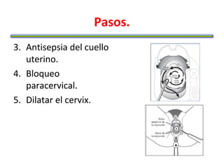 Pasos.
3. Antisepsia del cuello
   uterino.
4. Bloqueo
   paracervical.
5. Dilatar el cervix.
 