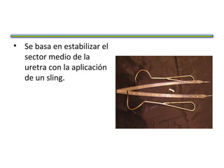 • Se basa en estabilizar el
  sector medio de la
  uretra con la aplicación
  de un sling.
 