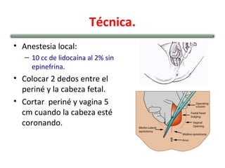 Técnica.
• Anestesia local:
   – 10 cc de lidocaína al 2% sin
     epinefrina.
• Colocar 2 dedos entre el
  periné y la cabeza fetal.
• Cortar periné y vagina 5
  cm cuando la cabeza esté
  coronando.
 