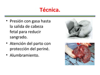 Técnica.
• Presión con gasa hasta
  la salida de cabeza
  fetal para reducir
  sangrado.
• Atención del parto con
  protección del periné.
• Alumbramiento.
 