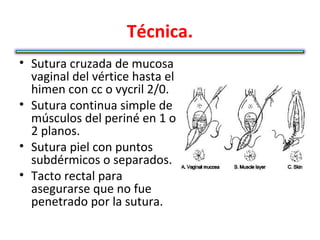 Técnica.
• Sutura cruzada de mucosa
  vaginal del vértice hasta el
  himen con cc o vycril 2/0.
• Sutura continua simple de
  músculos del periné en 1 o
  2 planos.
• Sutura piel con puntos
  subdérmicos o separados.
• Tacto rectal para
  asegurarse que no fue
  penetrado por la sutura.
 