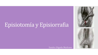 Episiotomía y Episiorrafia
Sandra Silgado Medrano
 