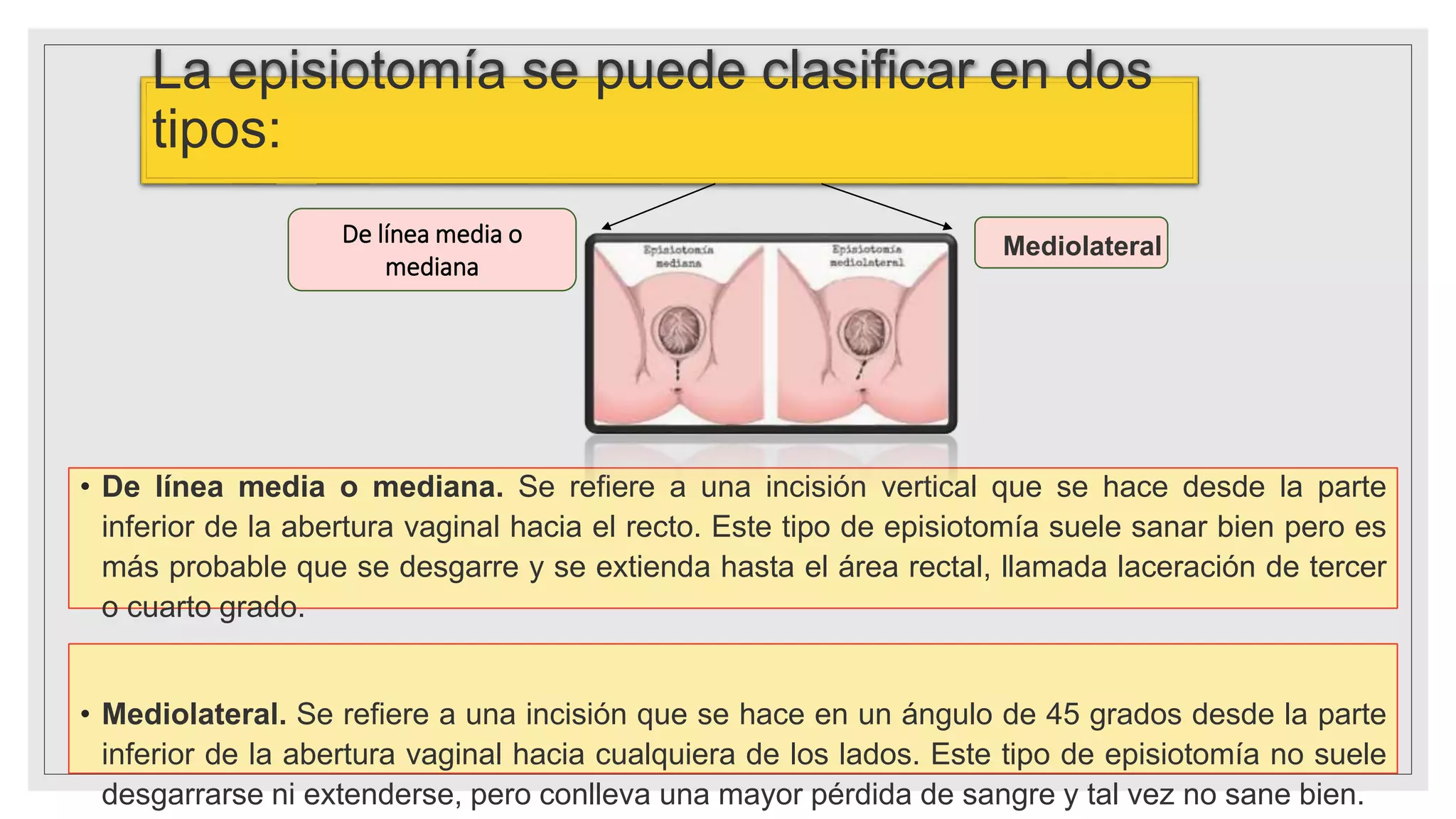 EPISIOTOMIA BERENNI CORTES RDY.pptx
