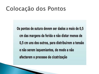 Episiotomia, episiorrafia e suturas