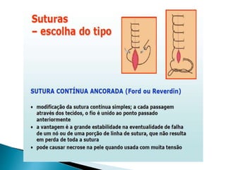 Episiotomia, episiorrafia e suturas