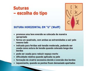 Episiotomia, episiorrafia e suturas