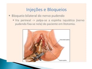 Episiotomia, episiorrafia e suturas