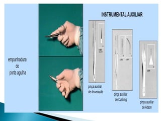 Episiotomia, episiorrafia e suturas