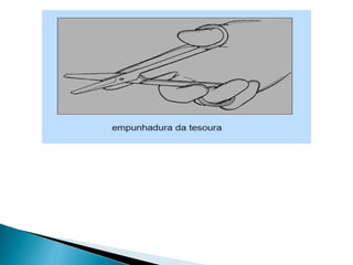 Episiotomia, episiorrafia e suturas