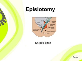 Page 1
Episiotomy
Shrooti Shah
 