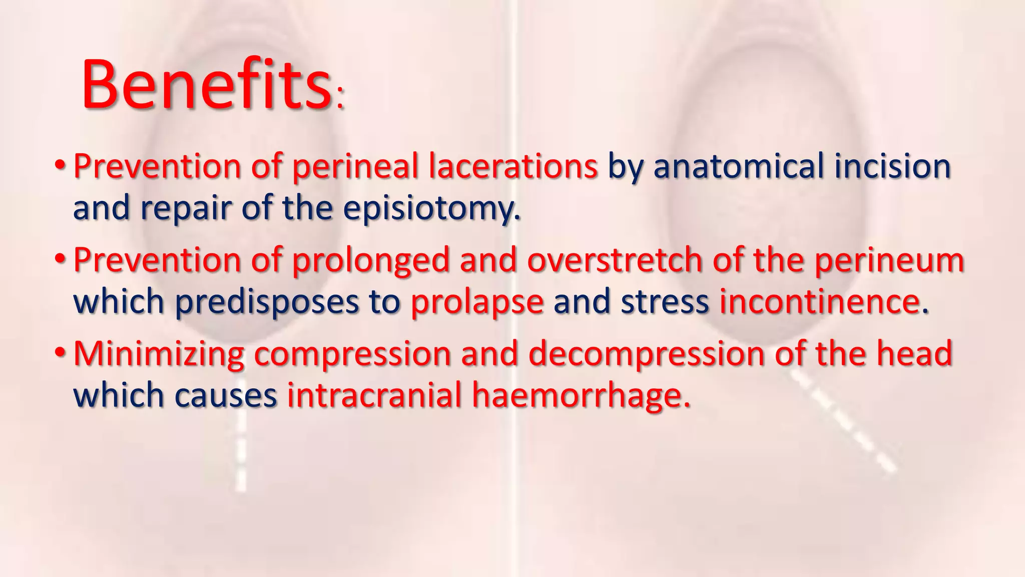 Episiotomy | PPTX