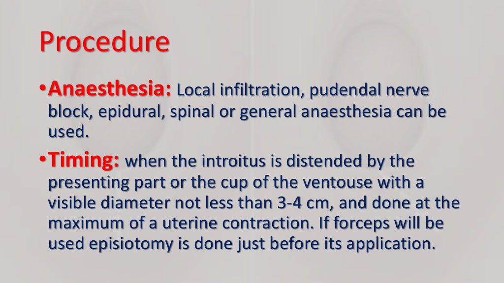 Episiotomy