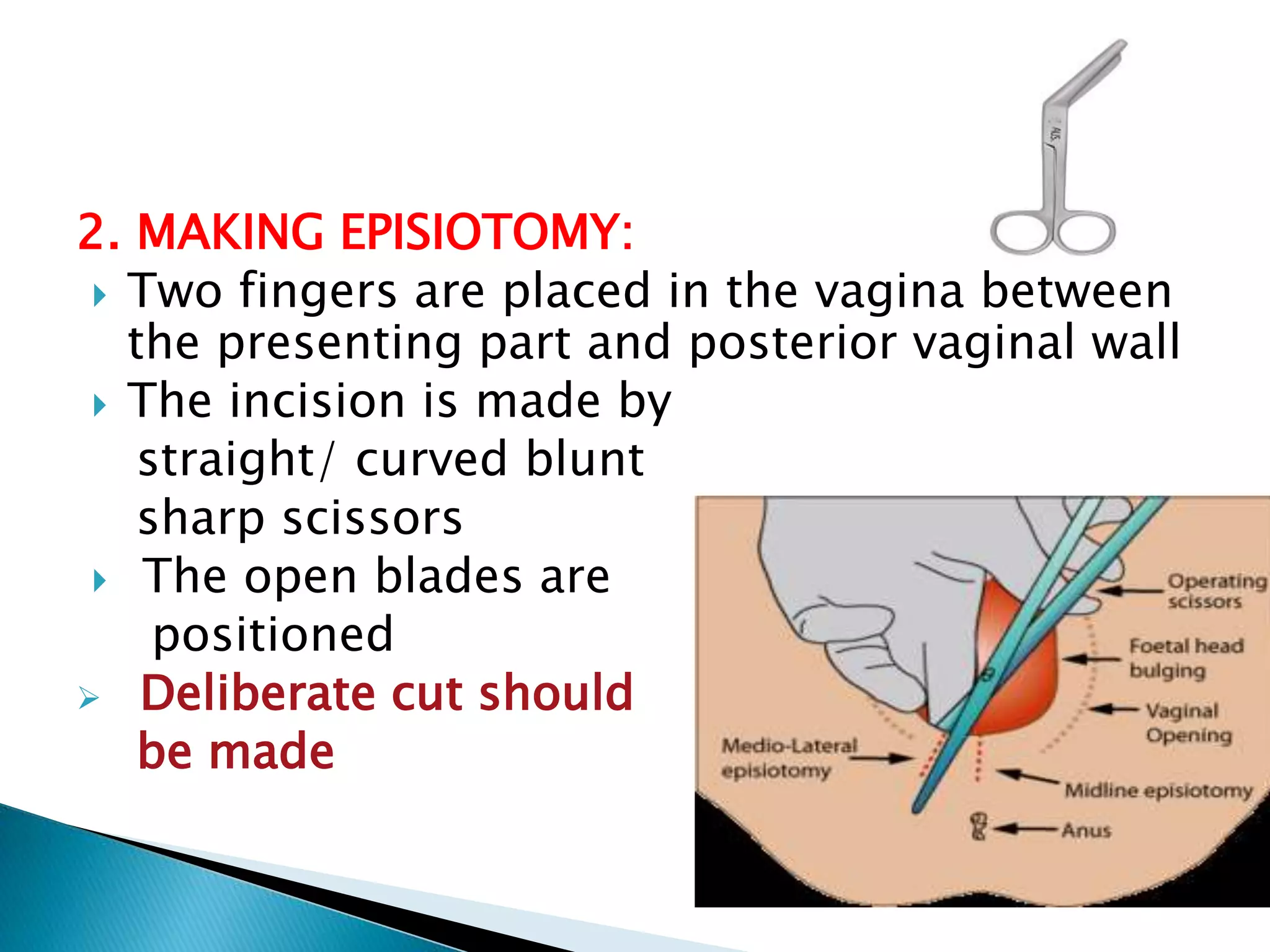 EPISIOTOMY AND ITS REPAIR pptx episiotomy-and-its-repair-pptx