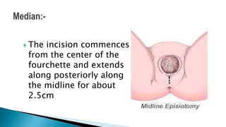  The incision commences
from the center of the
fourchette and extends
along posteriorly along
the midline for about
2.5cm
 