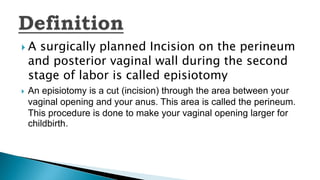  A surgically planned Incision on the perineum
and posterior vaginal wall during the second
stage of labor is called episiotomy
 An episiotomy is a cut (incision) through the area between your
vaginal opening and your anus. This area is called the perineum.
This procedure is done to make your vaginal opening larger for
childbirth.
 