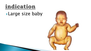 Large size baby
 