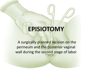 EPISIOTOMY
A surgically planned incision on the
perineum and the posterior vaginal
wall during the second stage of labor
 
