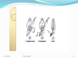 10-01-2024 I msc nursing 23
 