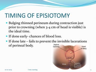 TIMING OF EPISIOTOMY
 Bulging thinned perineum during contraction just
prior to crowning (when 3-4 cm of head is visible) is
the ideal time.
 If done early- chances of blood loss.
 If done late – fails to prevent the invisible lacerations
of perineal body.
10-01-2024 I msc nursing 5
 