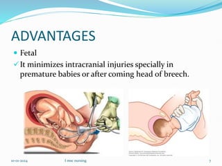 ADVANTAGES
 Fetal
It minimizes intracranial injuries specially in
premature babies or after coming head of breech.
10-01-2024 I msc nursing 7
 