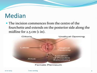 Median
 The incision commences from the centre of the
fourchette and extends on the posterior side along the
midline for 2.5 cm (1 in).
10-01-2024 I msc nursing 9
 