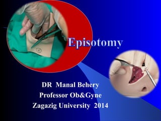 DR Manal Behery
Professor Ob&Gyne
Zagazig University 2014
 