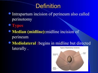 episotomy-for-undergraduate-ppt