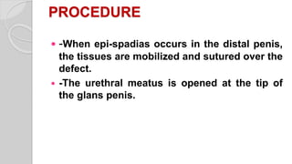PROCEDURE
 -When epi-spadias occurs in the distal penis,
the tissues are mobilized and sutured over the
defect.
 -The urethral meatus is opened at the tip of
the glans penis.
 