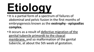Etiology
• It is a partial form of a spectrum of failures of
abdominal and pelvic fusion in the first months of
embryogenesis known as the exstrophy - epispadias
complex.
• It occurs as a result of defective migration of the
genital tubercle primordii to the cloacal
membrane, and so malformation of the genital
tubercle, at about the 5th week of gestation.

 