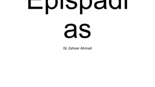 Epispadi
as
Dr. Zahoor Ahmad

 