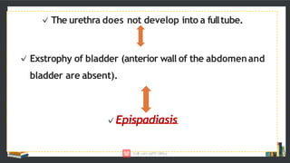EPISPADIASIS CHN PRESENTATION.pptx
