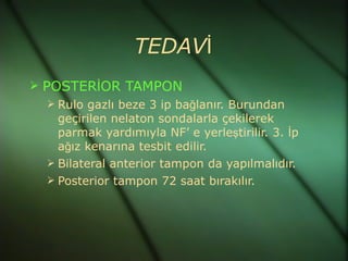 TEDAVİ
 POSTERİOR TAMPON
    Rulo gazlı beze 3 ip bağlanır. Burundan
     geçirilen nelaton sondalarla çekilerek
     parmak yardımıyla NF’ e yerleştirilir. 3. İp
     ağız kenarına tesbit edilir.
    Bilateral anterior tampon da yapılmalıdır.
    Posterior tampon 72 saat bırakılır.
 