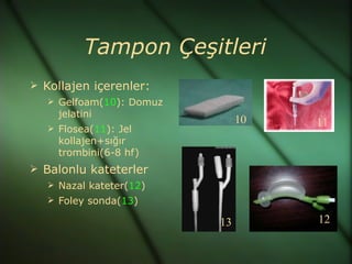 Tampon Çeşitleri
 Kollajen içerenler:
    Gelfoam(10): Domuz
     jelatini
                               10   11
    Flosea(11): Jel
     kollajen+sığır
     trombini(6-8 hf)
 Balonlu kateterler
    Nazal kateter(12)
    Foley sonda(13)

                          13        12
 