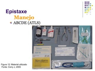 ABCDE (ATLS)
Manejo
Epistaxe
Figura 12: Material utilizado
Fonte: Corry J, 2005
 