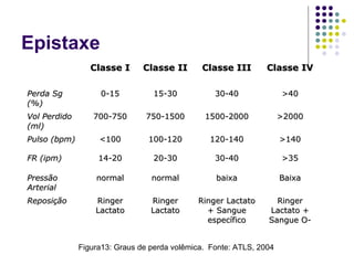 Epistaxe
Figura13: Graus de perda volêmica. Fonte: ATLS, 2004
Classe IClasse I Classe IIClasse II Classe IIIClasse III Classe IVClasse IV
Perda SgPerda Sg
(%)(%)
0-150-15 15-3015-30 30-4030-40 >40>40
Vol PerdidoVol Perdido
(ml)(ml)
700-750700-750 750-1500750-1500 1500-20001500-2000 >2000>2000
Pulso (bpm)Pulso (bpm) <100<100 100-120100-120 120-140120-140 >140>140
FR (ipm)FR (ipm) 14-2014-20 20-3020-30 30-4030-40 >35>35
PressãoPressão
ArterialArterial
normalnormal normalnormal baixabaixa BaixaBaixa
ReposiçãoReposição RingerRinger
LactatoLactato
RingerRinger
LactatoLactato
Ringer LactatoRinger Lactato
+ Sangue+ Sangue
específicoespecífico
RingerRinger
Lactato +Lactato +
Sangue O-Sangue O-
 