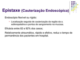 Epistaxe (Cauterização Endoscópica)
Endoscópio flexível ou rígido:

Localização seguida de cauterização da região da a.
esfenopalatina e pontos de sangramento na mucosa.
Eficácia entre 82 e 92% dos casos;
Relativamente atraumático, rápido e efetivo, reduz o tempo de
permanência dos pacientes em hospital.
 