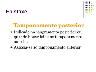Indicado no sangramento posterior ou
quando houve falha no tamponamento
anterior
Associa-se ao tamponamento anterior
Tamponamento posterior
Epistaxe
 