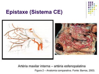 Epistaxe (Sistema CE)
Artéria maxilar interna – artéria esfenopalatina
Figura 2 – Anatomia comparativa. Fonte: Barros, 2003.
 