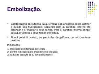 Embolização.

Cateterização percutânea da a. femoral sob anestesia local, cateter
é guiado sob fluoroscopia, seguindo pela a. carótida externa até
alcançar a a. maxilar e seus ramos. Pela a. carótida interna atinge-
se a a. oftálmica e seus ramos etmoidais.

Álcool polivinil (Ivalon), ou partículas de gelfoam, ou micro-esferas
dextran.
Indicações:
1) Insucesso com tampão posterior;
2) Contra-indicação para procedimento cirúrgico;
3) Falha da ligadura da a. etmoidal anterior.
 