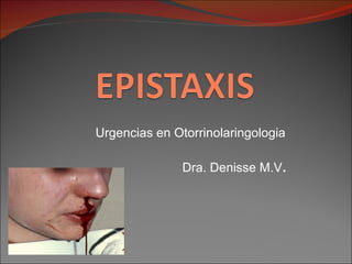 Urgencias en Otorrinolaringologia Dra. Denisse M.V . 